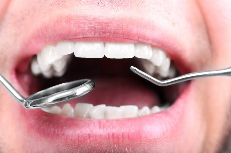 Rehabilitación Oral - Omnisalud